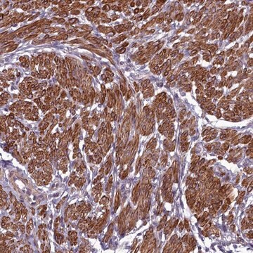 Anti-ZNF626 antibody produced in rabbit Prestige Antibodies&#174; Powered by Atlas Antibodies, affinity isolated antibody, buffered aqueous glycerol solution