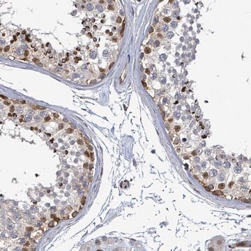 Anti-TUSC1 antibody produced in rabbit Prestige Antibodies&#174; Powered by Atlas Antibodies, affinity isolated antibody, buffered aqueous glycerol solution