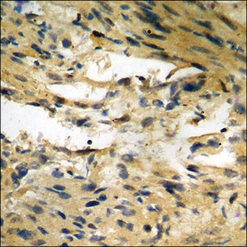 Anti-phospho-Merlin (pSer10) antibody produced in rabbit affinity isolated antibody