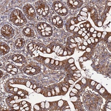 Anti-TMEM176B antibody produced in rabbit Prestige Antibodies&#174; Powered by Atlas Antibodies, affinity isolated antibody, buffered aqueous glycerol solution