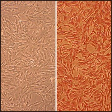 Bovine Coronary Artery Smooth Muscle Cells: BCASMC (Cryovial)