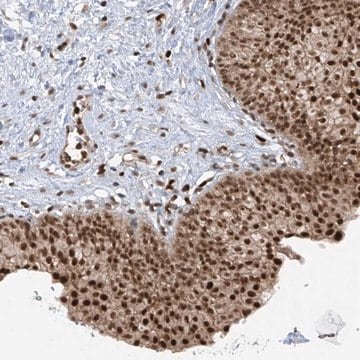 Anti-REPIN1 antibody produced in rabbit Prestige Antibodies&#174; Powered by Atlas Antibodies, affinity isolated antibody, buffered aqueous glycerol solution