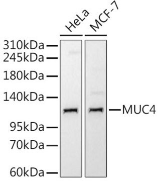 Anti-MUC4 Antibody, clone 5J3R7, Rabbit Monoclonal