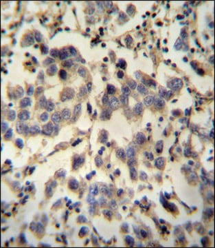 ANTI-C6ORF58 (CENTER) antibody produced in rabbit IgG fraction of antiserum, buffered aqueous solution