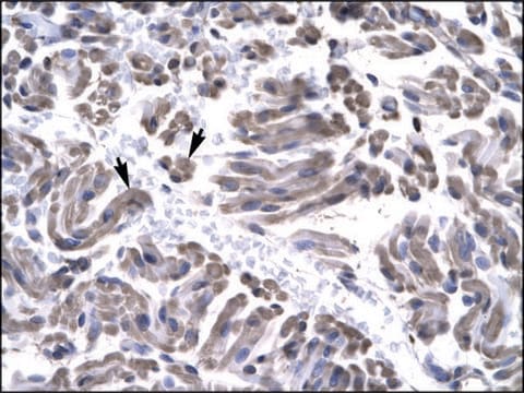 Anti-GTF2H3 antibody produced in rabbit affinity isolated antibody