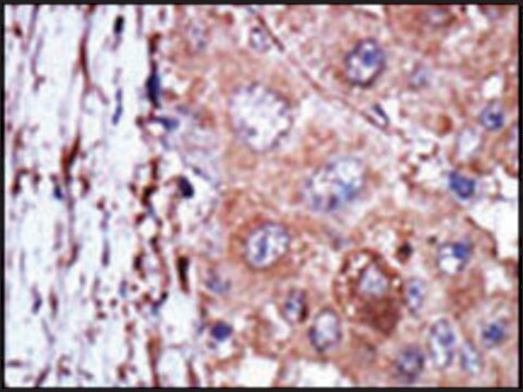 Anti-TRRAP (C-term) antibody produced in rabbit IgG fraction of antiserum, buffered aqueous solution