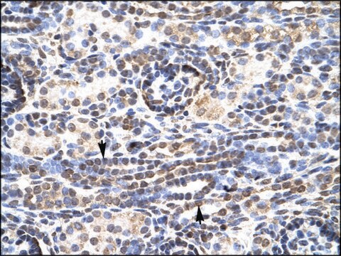 Anti-KLF9 antibody produced in rabbit affinity isolated antibody