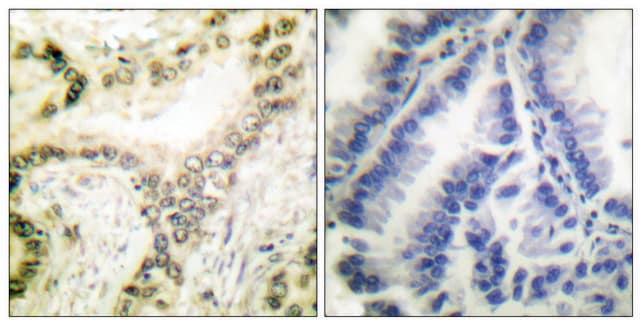 Anti-Histone H3 (Acetyl-Lys18) antibody produced in rabbit affinity isolated antibody