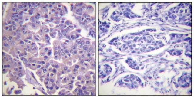 Anti-Caldesmon antibody produced in rabbit affinity isolated antibody