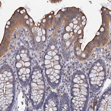 Anti-ACSM3 antibody produced in rabbit Prestige Antibodies&#174; Powered by Atlas Antibodies, affinity isolated antibody, buffered aqueous glycerol solution