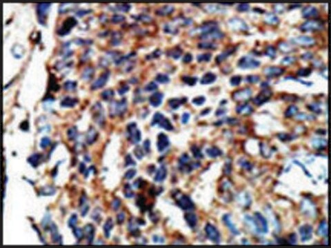 Anti-OPHN1L (C-term) antibody produced in rabbit IgG fraction of antiserum, buffered aqueous solution