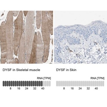 Anti-DYSF antibody produced in rabbit Prestige Antibodies&#174; Powered by Atlas Antibodies, affinity isolated antibody, buffered aqueous glycerol solution