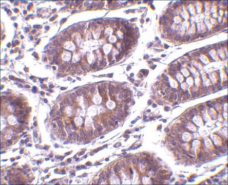 Anti-MICA antibody produced in rabbit affinity isolated antibody, buffered aqueous solution