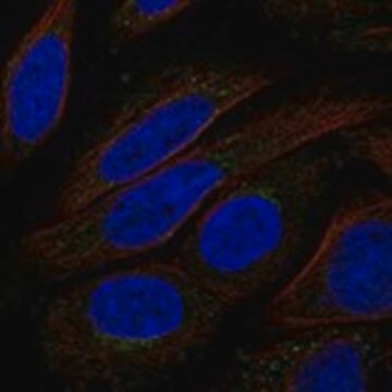 Anti-TMEM168 antibody produced in rabbit Prestige Antibodies&#174; Powered by Atlas Antibodies, affinity isolated antibody, buffered aqueous glycerol solution