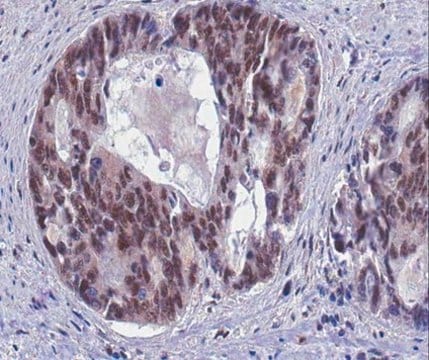 Anti-GADD45 alpha Antibody from rabbit, purified by affinity chromatography