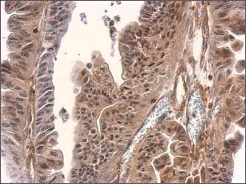 Anti-SMAD3 antibody produced in rabbit