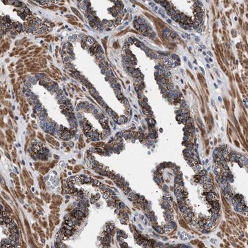 Anti-RAB34 antibody produced in rabbit Prestige Antibodies&#174; Powered by Atlas Antibodies, affinity isolated antibody, buffered aqueous glycerol solution