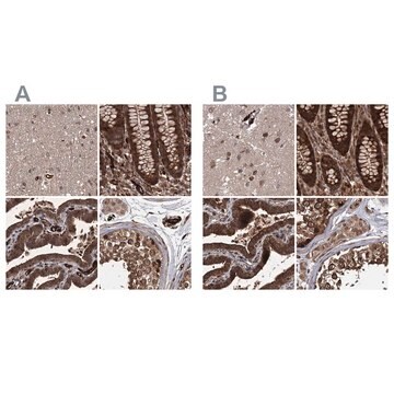 Anti-RPAP3 antibody produced in rabbit Prestige Antibodies&#174; Powered by Atlas Antibodies, affinity isolated antibody, buffered aqueous glycerol solution