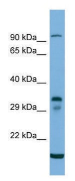 Anti-TM6SF2 (C-terminal) antibody produced in rabbit affinity isolated antibody