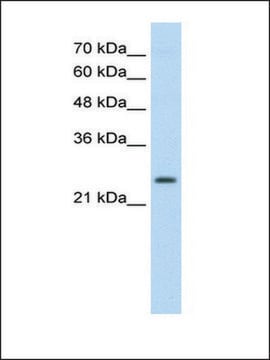 Anti-TSHR (AB2) antibody produced in rabbit affinity isolated antibody