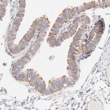 Anti-RPS21 antibody produced in rabbit Prestige Antibodies&#174; Powered by Atlas Antibodies, affinity isolated antibody, buffered aqueous glycerol solution