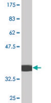 Monoclonal Anti-MPHOSPH10 antibody produced in mouse clone 1E12, purified immunoglobulin, buffered aqueous solution