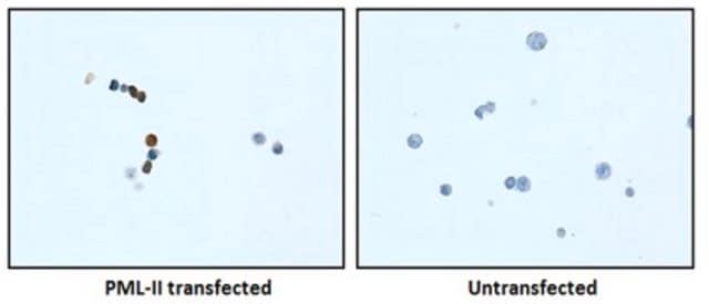 Anti-PML Isoform II Antibody, clone 1A8.1 clone 1A8.1, from mouse