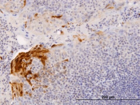 Anti-S100A7 antibody produced in mouse IgG fraction of antiserum, buffered aqueous solution