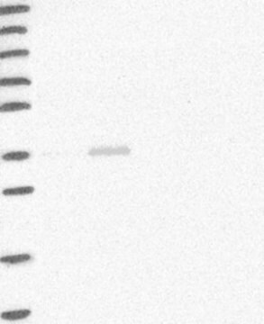 Anti-HAO2 antibody produced in rabbit Prestige Antibodies&#174; Powered by Atlas Antibodies, affinity isolated antibody, buffered aqueous glycerol solution