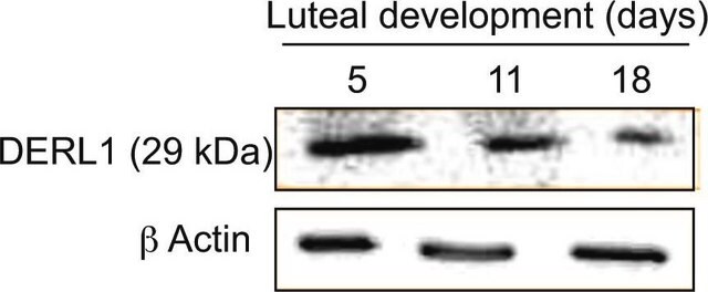 Anti-Derlin-1 antibody produced in rabbit ~1&#160;mg/mL, affinity isolated antibody, buffered aqueous solution