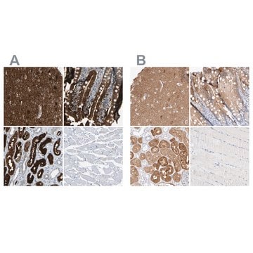 Anti-GDA antibody produced in rabbit Prestige Antibodies&#174; Powered by Atlas Antibodies, affinity isolated antibody, buffered aqueous glycerol solution