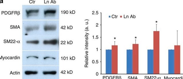 Anticorps monoclonal anti-&#945;-actine de muscle lisse clone 1A4, purified from hybridoma cell culture