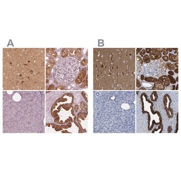 Anti-CRYM antibody produced in rabbit Prestige Antibodies&#174; Powered by Atlas Antibodies, affinity isolated antibody