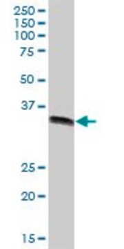 Anti-GIPC2 antibody produced in mouse purified immunoglobulin, buffered aqueous solution