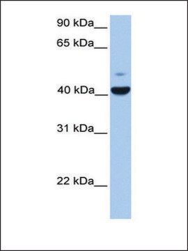 Anti-FGFR1OP (AB1) antibody produced in rabbit affinity isolated antibody