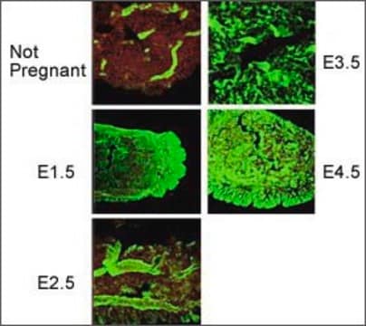 Anti-PORCN antibody produced in rabbit affinity isolated antibody