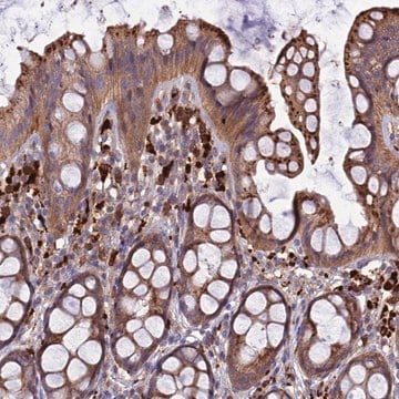 Anti-CARMIL2 antibody produced in rabbit Prestige Antibodies&#174; Powered by Atlas Antibodies, affinity isolated antibody, buffered aqueous glycerol solution