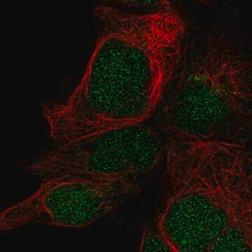 Anti-LYSMD1 antibody produced in rabbit Prestige Antibodies&#174; Powered by Atlas Antibodies, affinity isolated antibody