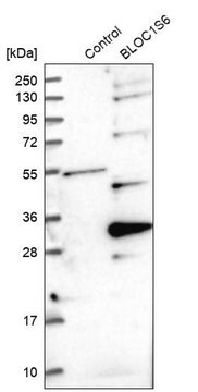 Anti-BLOC1S6 antibody produced in rabbit Prestige Antibodies&#174; Powered by Atlas Antibodies, affinity isolated antibody, buffered aqueous glycerol solution