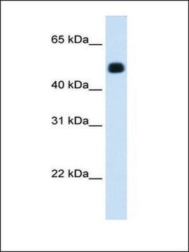 Anti-HMGCS2 (AB2) antibody produced in rabbit IgG fraction of antiserum