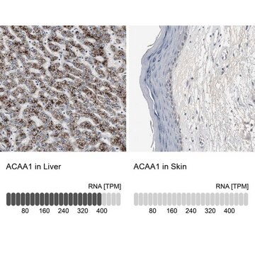 Anti-ACAA1 antibody produced in rabbit Ab1, Prestige Antibodies&#174; Powered by Atlas Antibodies, affinity isolated antibody, buffered aqueous glycerol solution