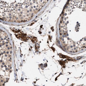 Anti-SLC4A11 antibody produced in rabbit Prestige Antibodies&#174; Powered by Atlas Antibodies, affinity isolated antibody, buffered aqueous glycerol solution