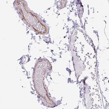 Anti-EML5 antibody produced in rabbit Prestige Antibodies&#174; Powered by Atlas Antibodies, affinity isolated antibody, buffered aqueous glycerol solution