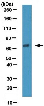 Anti-ATDC Antibody from rabbit, purified by affinity chromatography