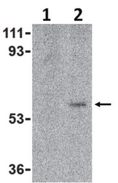 Anti-Toso Antibody from rabbit, purified by affinity chromatography