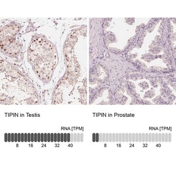 Anti-TIPIN antibody produced in rabbit Prestige Antibodies&#174; Powered by Atlas Antibodies, affinity isolated antibody, buffered aqueous glycerol solution