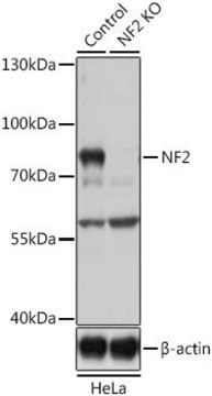 Anti-NF2 antibody produced in rabbit