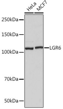 Anti-LGR6 Antibody, clone 8J2J10, Rabbit Monoclonal