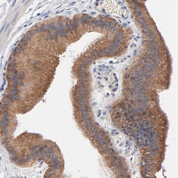 Anti-VAV2 antibody produced in rabbit Prestige Antibodies&#174; Powered by Atlas Antibodies, affinity isolated antibody, buffered aqueous glycerol solution