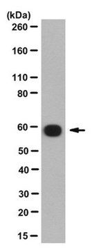 Anti-PPIase FKBP4 Antibody, clone KN382/EC1 clone KN382/EC1, from mouse